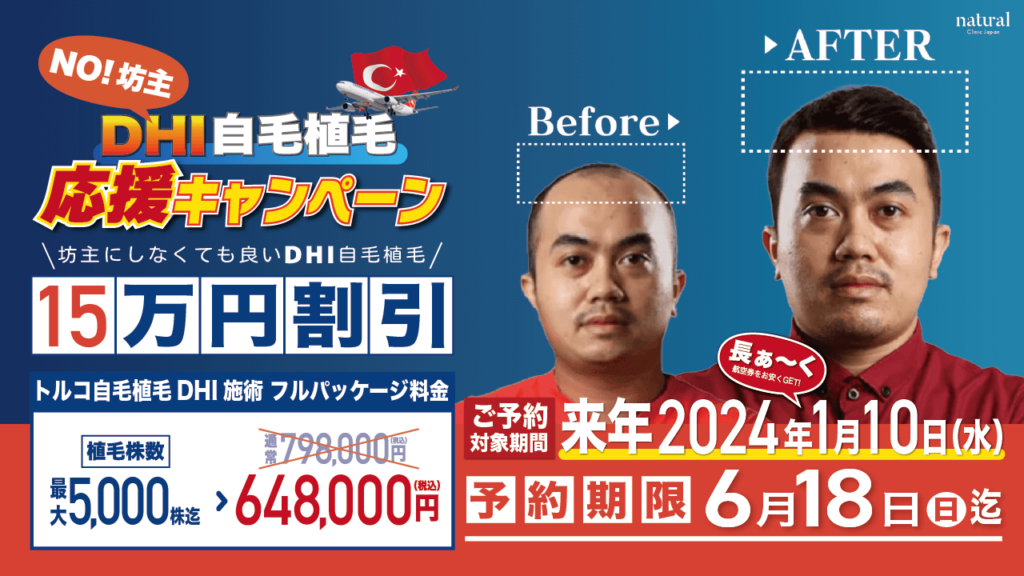 【話題のトルコ自毛植毛】期間限定15万円OFF!最大5,000株まで648,000円！